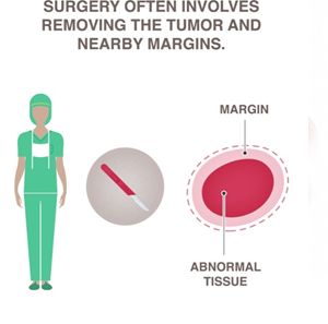 treatment of breast cancer